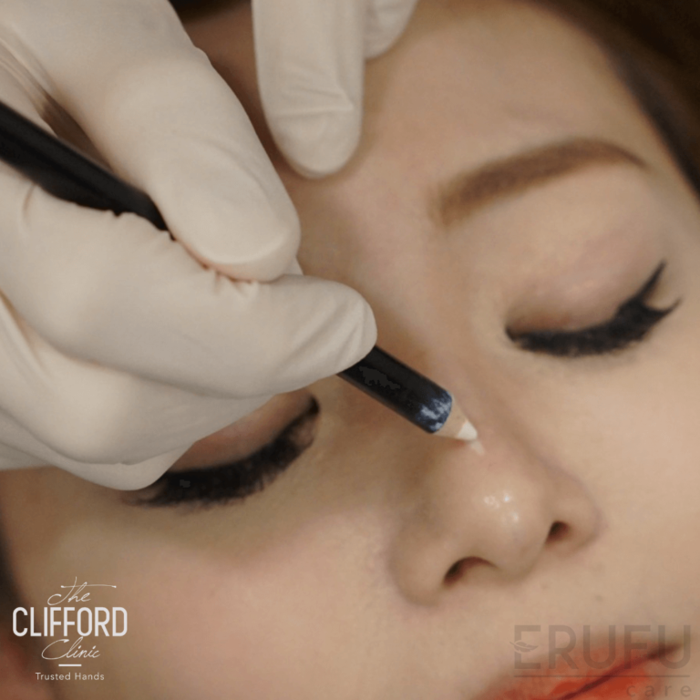 Want Star-Quality Eyes? These 5 Clinics Will Transform Your Look in 2025